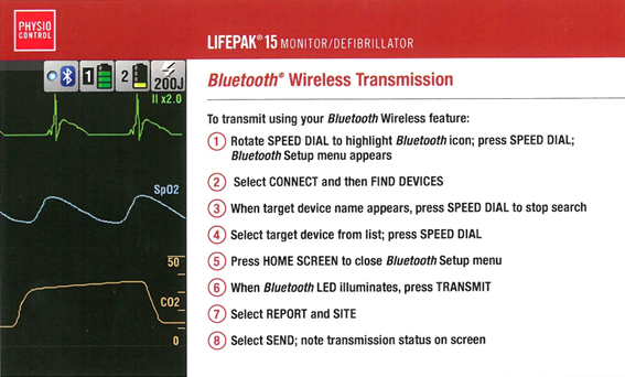 EKG Bluetooth Wireless Transmission